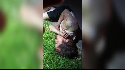 Nampa teen brutally beaten by juveniles at city park