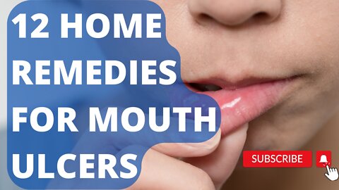 12 Home remedies for Mouth Ulcers