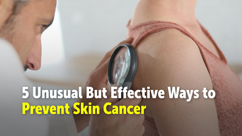 5 Ways to Prevent Skin Cancer