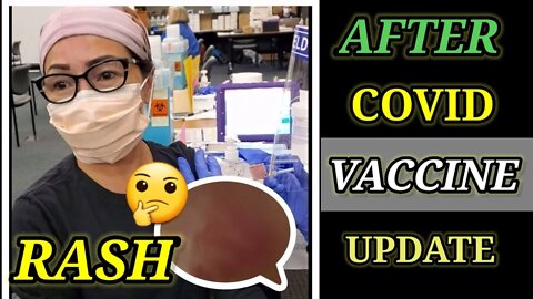 RASH AFTER COVID-19 MODERNA VACCINE:🤔 (Tess Respiratory Therapist)