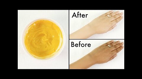 How To Remove Tan From Face,Neck,Hands,Knees Overnight- Simple home remedy