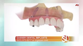 Gasser Dental Implants: Change your life with dental implants