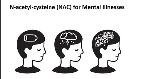 N Acetyl Cysteine - NAC - Surprising Natural Mental Illness Treatment