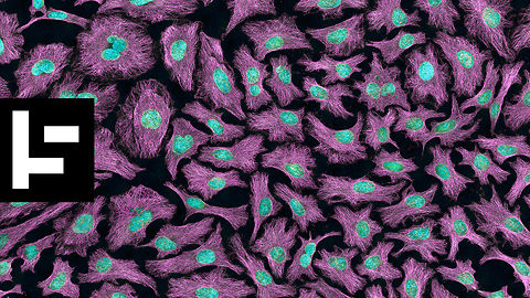 Henrietta Lacks: The Unknown Woman Who Helped Save Modern Medicine