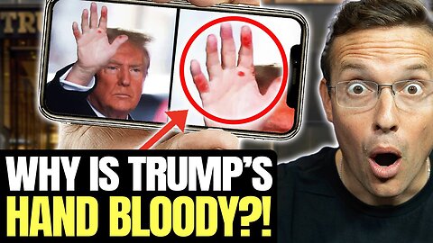 Reporter Asks Trump About His BLOODY Red Hand, Answer Makes Room ERUPT 🤣🔥