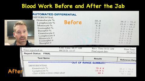 Blood Work Before and After the Jab