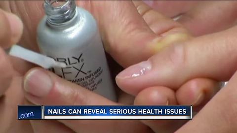 Doctors warn to check your nails for dangerous skin cancer