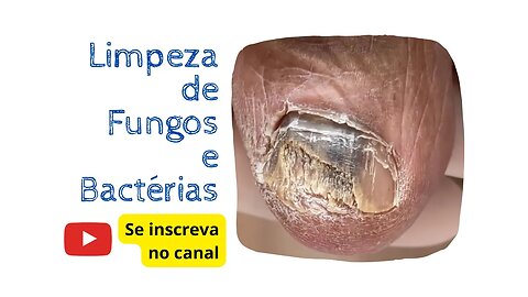 Higienização dos pés corte e limpeza de unhas dos pés - fácil e rápido! #podologia #nails #health