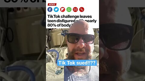 Tik Tok trend = 76% body covered in burns. #antilawyerlawyer #antilawyer #byronbrowne #getjudged