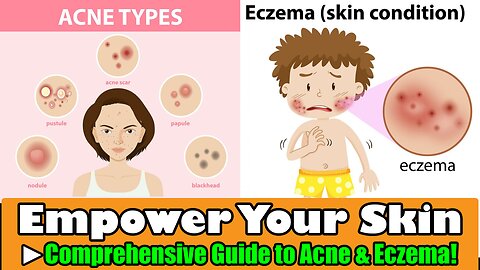 Empower Your Skin - Comprehensive Guide to Acne & Eczema