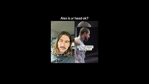 Alex Terrible Bashes Head #alexterrible