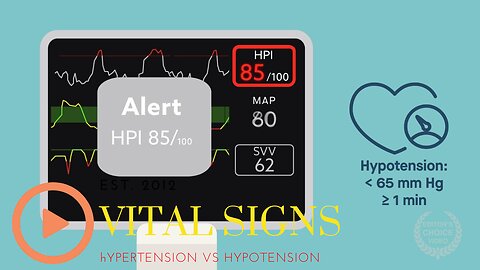 Vital Sign-Hypotension; Algoritm