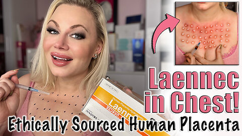 Ethically Sourced Human Placenta, Laennec in Chest! AceCosm | Code jessica10 saves you Money!