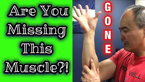 *Missing Muscle* Palmaris Longus Test! | Dr Wil & Dr K