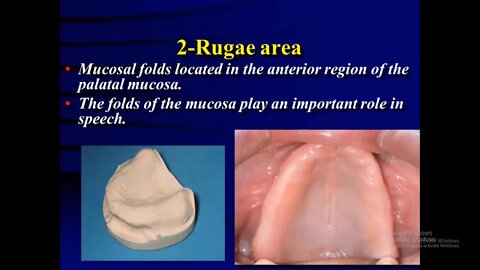 Prosthodontics L1 part1 (Anatomical landmarks of edentulous arches)