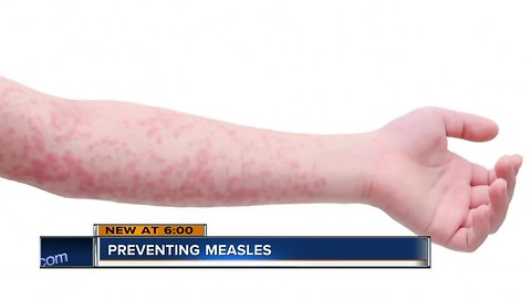 "It's only a matter of time." Measles outbreak spreading