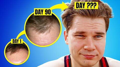 How Long Does It Take To See That Finasteride Really Work?