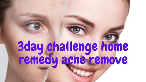 3 day challenge home remedy acne remove