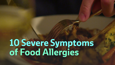 10 Severe Symptoms of Food Allergies