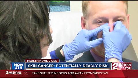 Health News 2 Use: Skin cancer