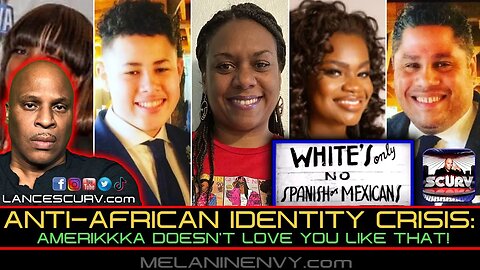 ANTI-AFRICAN IDENTITY CRISIS: AMERIKKKA DOESNT LOVE YOU LIKE THAT! | LANCESCURV