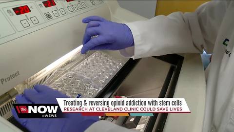 Cleveland Clinic lab finds stem cells can prevent and reverse opioid tolerance