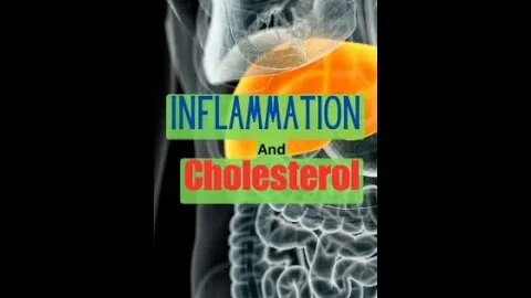 Why Is My Cholesterol High?