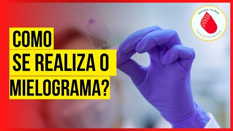 NÃO DEIXE DE VER! Como é realizado o MIELOGRAMA? | Geydson Cruz [MD,MSc]