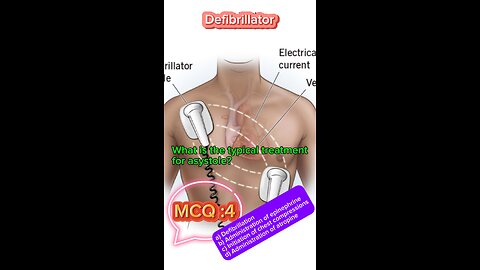 Defibrillator machine in icu #defibrillator #mcqs #pharmacologynotes #MedicalQuiz #mcqs #quiz