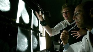 Genetic Breast Cancer Testing Guidelines May Lead To Missed Cases