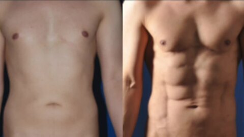 Advanced Body Sculpting Institute // Modern Liposuction Technology Put To Work!