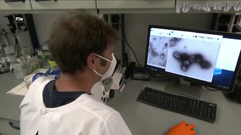 St. Pete doctor looking for new ways to detect, stop the spread of Monkeypox