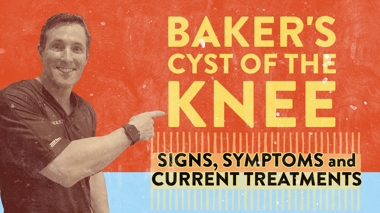 Baker's cyst of the knee Signs, symptoms and current treatments