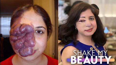 People Said I Shouldn’t Leave The House | SHAKE MY BEAUTY