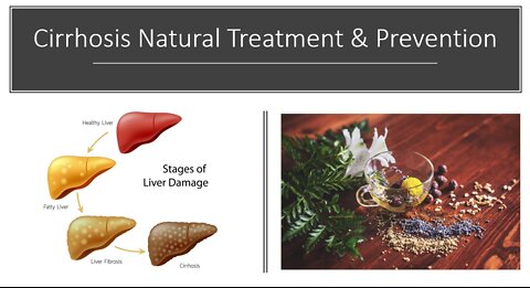 Cirrhosis Of The Liver - Natural Treatment