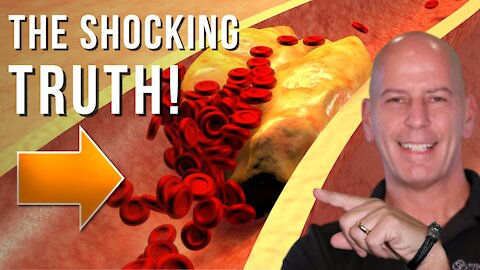 The SHOCKING TRUTH about Cholesterol!