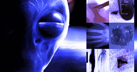 Alien Implants