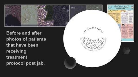 ZANDRE BOTHA: POST COVID JAB PROTOCOL'S - BLOOD BEFORE AND AFTER