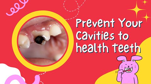 Prevent Cavities for Healthy Teeth