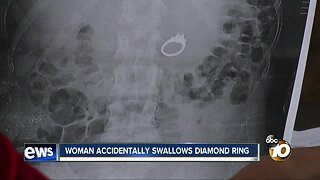 San Diego woman swallows engagement ring while sleeping