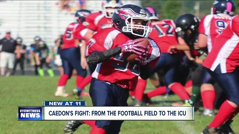 Midget football player in ICU with brain bleed