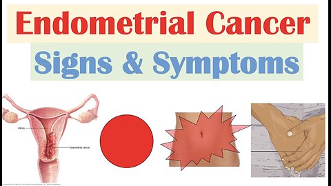 Endometrial Cancer Signs & Symptoms (& Why They Occur)