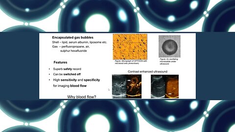 Microbubbles Contrast Agents for Biomedical Imaging - Prof. Xing Tang for Imperial College London