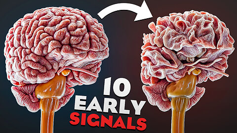 10 Silent WARNING Signs That You're About To Get Dementia