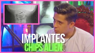 IMPLANTES E CHIPS ALIEN - PARANORMAL EXPERIENCE