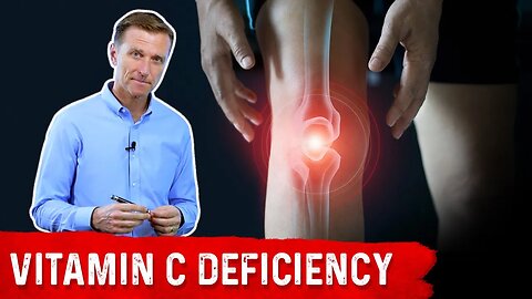 Could Your Joint Pain Be a Vitamin C Deficiency? – Dr.Berg