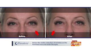 Erase Under-Eye Bags & Puffiness