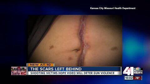 Survivor's videos highlight grim reality of gun violence in Kansas City