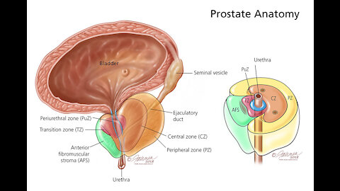 10 Warning Signs of Prostate Cancer