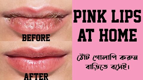 Get Soft Pink Lips at home | Overnight Care Pigmented & Dry Lips